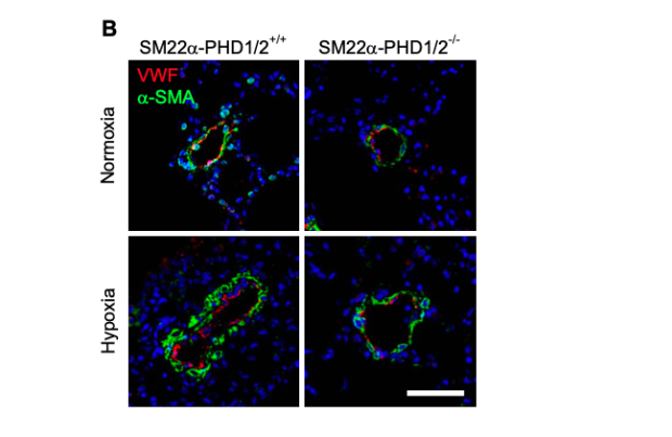 Vascular remodeling is attenuated in SM22-PHD1/2-/- mice exposed to hypoxia. 